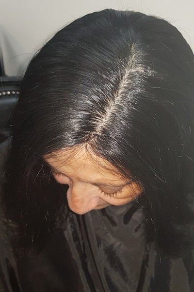 after female integration topper at birmingham hair loss salon