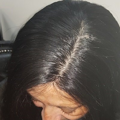 after female integration topper at birmingham hair loss salon Copy