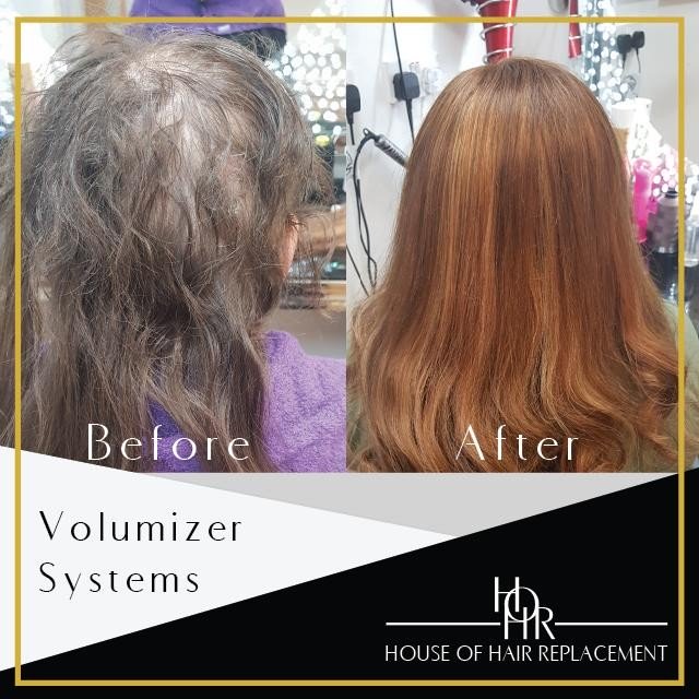 Female Hair Replacement 4 Day Course