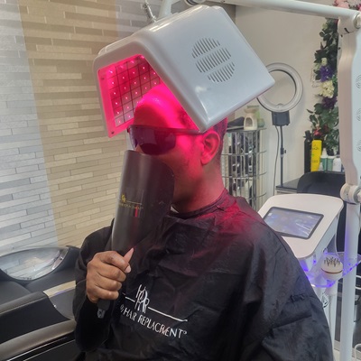 laser hair growth therapy at best hair replacement salon in Birmingham
