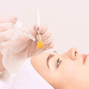 chemical peels at house of hair replacement in Birmingham chemical peels at house of hair replacement in Birmingham