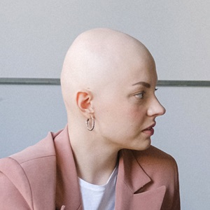 Scalp injections at house of hair replacement in Birmingham
