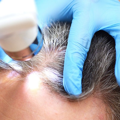 trichology hair loss consultations in Birmingham