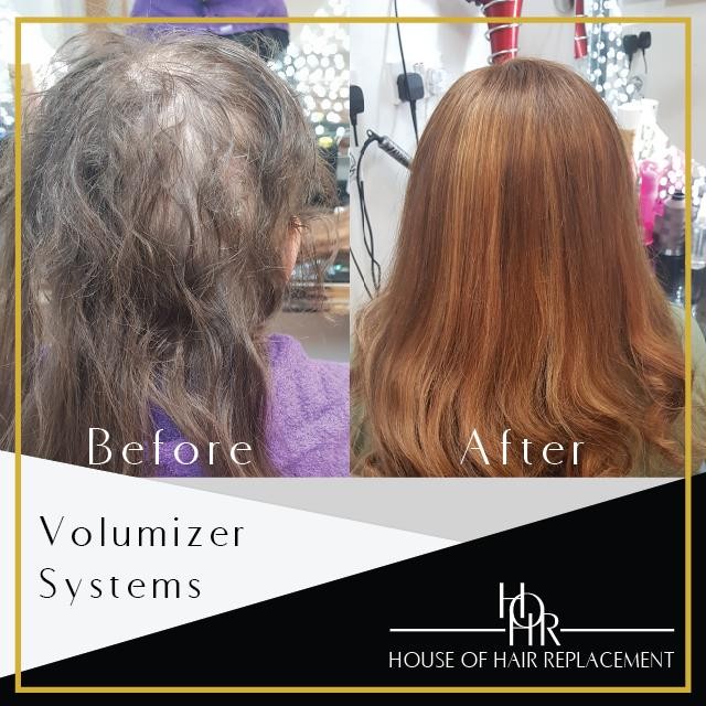 Female Hair Replacement 4 Day Course Female Hair Replacement 4 Day Course