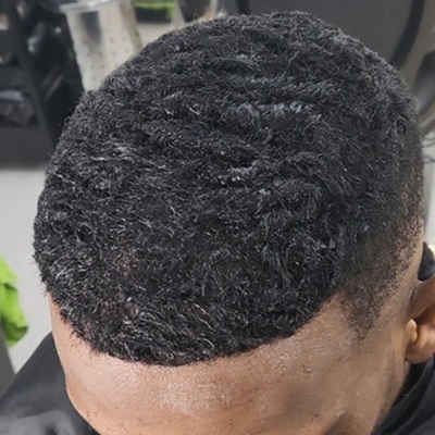 Cranial prosthesis to cover baldness