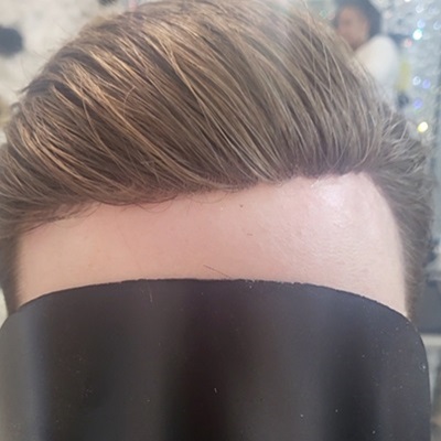 Hair systems to disguise receding hairlines
