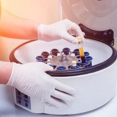 PRP hair loss treatments at House of Hair Replacement in Birmingham