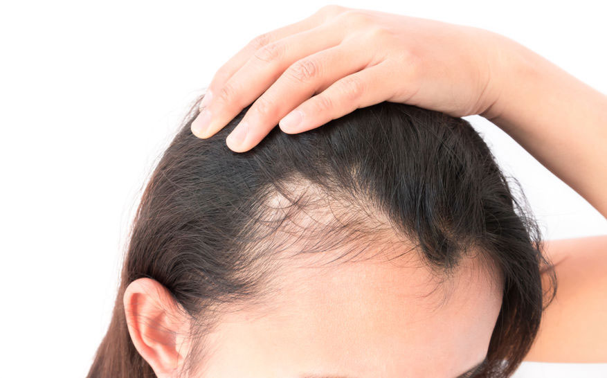 hair loss courses in Birmingham
